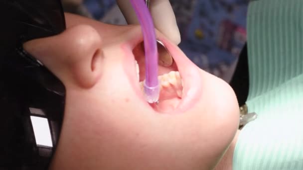 Giovane donna alla clinica dentale — Video Stock