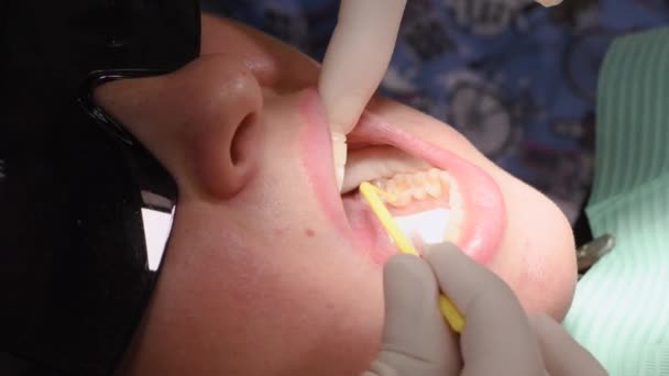 Молодая женщина в зубной клинике — стоковое видео