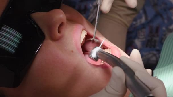 Mujer joven en la clínica dental — Vídeos de Stock