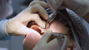Yaşlı kadın diş implantı yaptırıyor.
