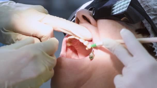 Femme âgée obtenant un implant dentaire — Video