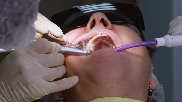 Mulher idosa recebendo implante dentário — Vídeo de Stock