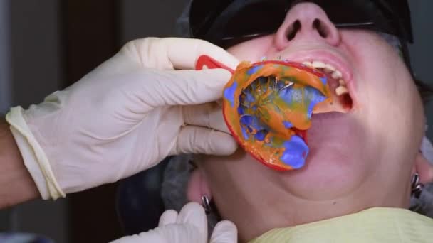 Donna anziana ottenere impianto dentale — Video Stock