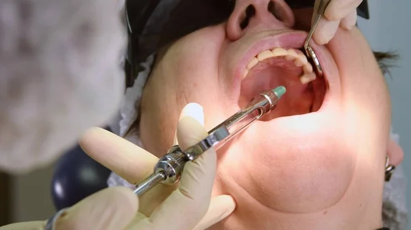 Senior woman getting dentální implant — Stock fotografie