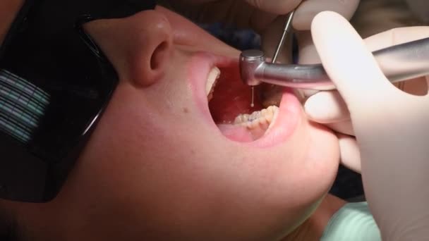 Mujer joven en la clínica dental — Vídeo de stock