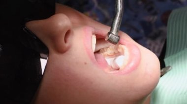 Dişçi kliniğindeki genç kadın.