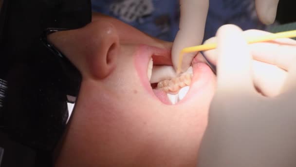 Mladá žena na zubní klinice — Stock video