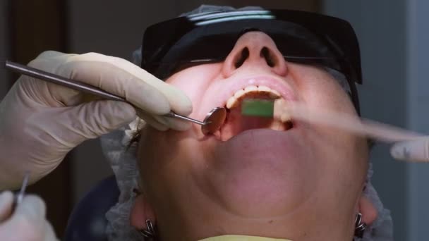 Senior kvinna som får tandimplantat — Stockvideo