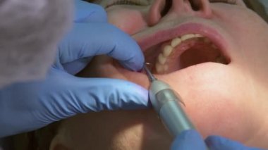 Yaşlı kadın diş implantı yaptırıyor.