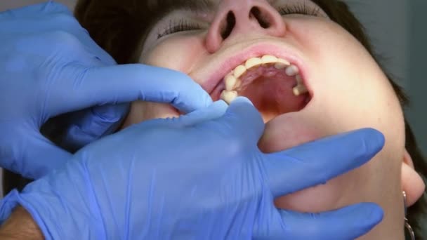 Yaşlı kadın diş implantı yaptırıyor. — Stok video