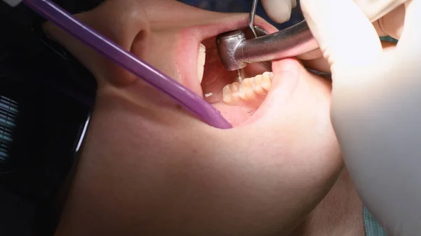 Ung kvinna på tandvårdskliniken — Stockfoto