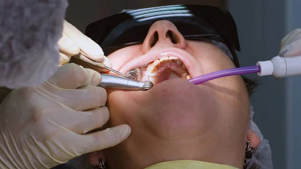 Senior woman getting dentální implant — Stock fotografie