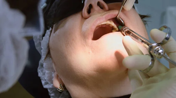 Senior woman getting dentální implant — Stock fotografie