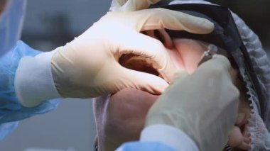Yaşlı kadın diş implantı yaptırıyor.