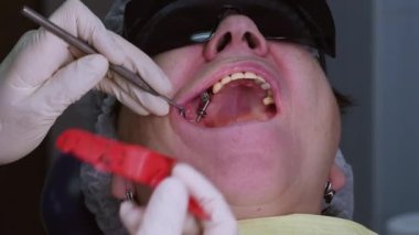 Yaşlı kadın diş implantı yaptırıyor.
