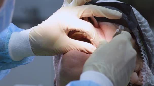 Femme âgée obtenant un implant dentaire — Video