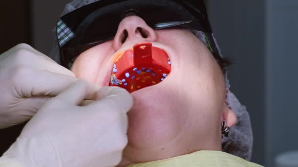 Mujer mayor recibiendo implante dental — Vídeos de Stock