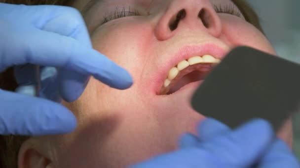 Femeia în vârstă care primește implant dentar — Videoclip de stoc