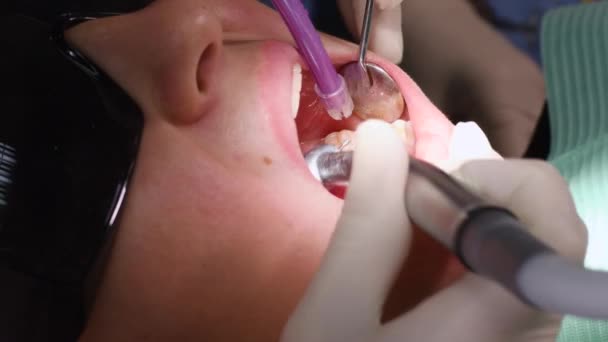 Jovem na clínica odontológica — Vídeo de Stock