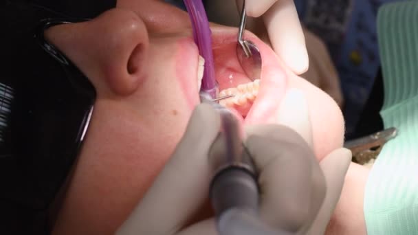 Young woman at dental clinic — Stock Video