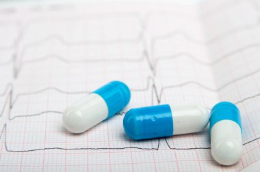 Kardiyogram haplarla mavi ve beyaz bir görüntü