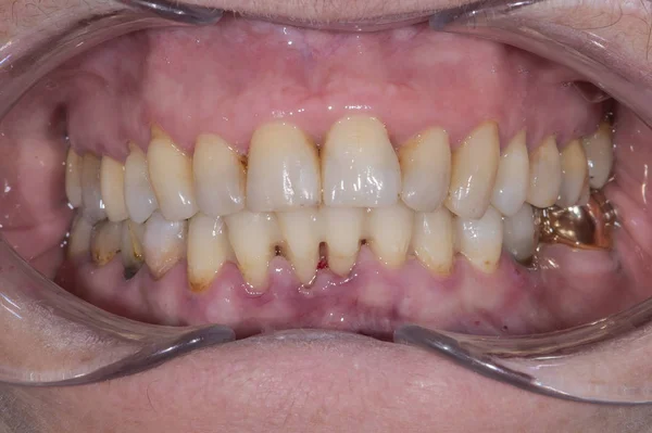 実際の患者歯科手術 — ストック写真