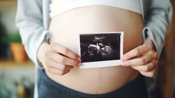 Primer plano de las mujeres embarazadas del vientre y las manos femeninas que sostienen la imagen de ultrasonido del feto sano. Embarazo, atención médica y concepto familiar feliz . — Vídeos de Stock