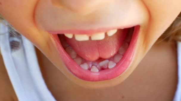 Το παιδί προσπαθεί να βγάλει το δεύτερο δόντι του με τα δάχτυλά του. — Αρχείο Βίντεο