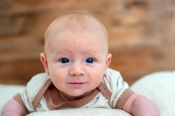 Allergien Neurodermitis Gesicht Eines Babys — Stockfoto