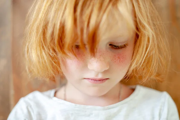 Ragazza Con Lentiggini Arrossire Luminoso — Foto Stock