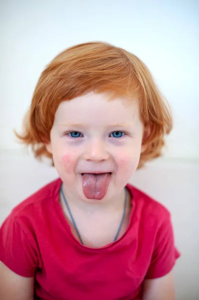 Ein Kind Mit Anzeichen Einer Allergie Gesicht — Stockfoto