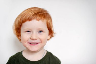 Yüzünde alerjisi olan çocuk