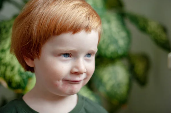 Хлопчик Алергією Обличчя — стокове фото