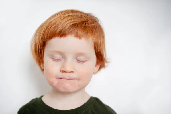 Boy Allergies His Face — Stock Photo, Image