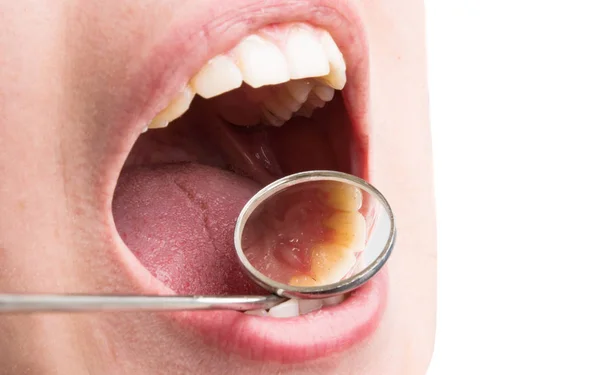 Leczenie Stomatologiczne Dentysty — Zdjęcie stockowe