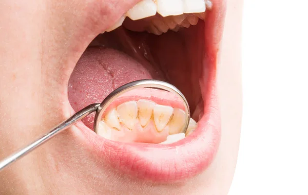 Tratamento Dentário Dentista — Fotografia de Stock