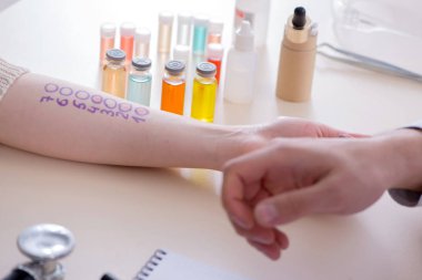 Hastanedeki hastanın alerji reaksiyonunu test eden doktor.