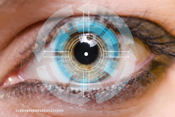 Concepto de sensor implantado en el ojo humano — Foto de Stock