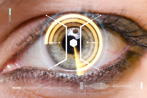 Concepto de sensor implantado en el ojo humano — Foto de Stock