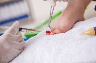 İşlem sırasında ayak tedavi uzmanı