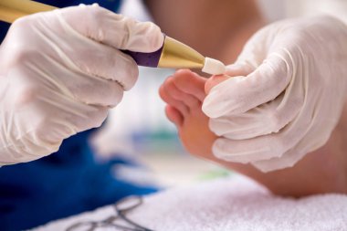 İşlem sırasında ayak tedavi uzmanı