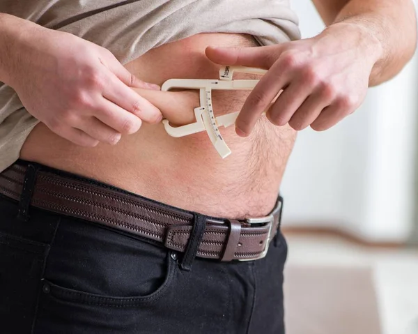 Hombre midiendo grasa corporal con pinzas — Foto de Stock