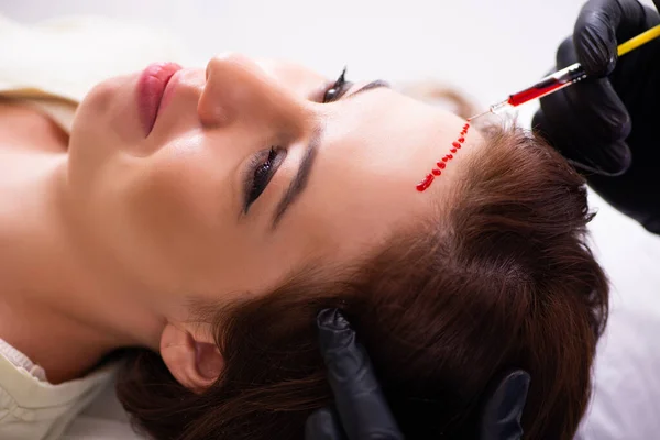 Mujer joven visitando a esteticista masculino en trasplante de cabello con —  Fotos de Stock