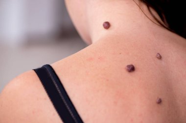 Genç bir kadın erkek doktor dermatoloğunu ziyaret ediyor.