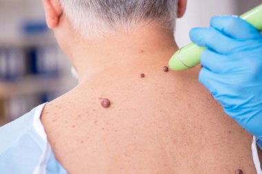 Yaşlı adam genç erkek doktor dermatoloğu ziyaret ediyor.
