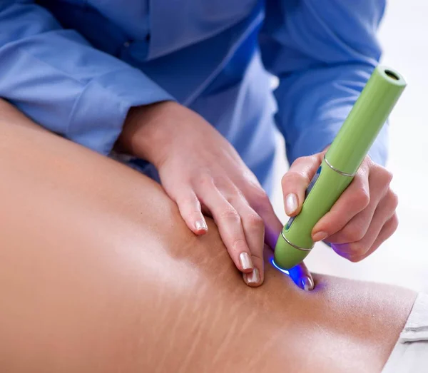 Patient in clinic undergoing laser scar removal — Stock Photo, Image