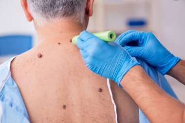 Yaşlı adam genç erkek doktor dermatoloğu ziyaret ediyor.