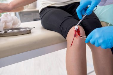 Erkek doktoru ziyaret eden bacağı yaralı bir kadın.