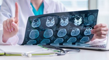 Doktor hastanede MRI görüntüsünü inceliyor.