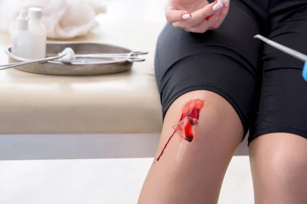 足の負傷女性訪問男性医師 — ストック写真